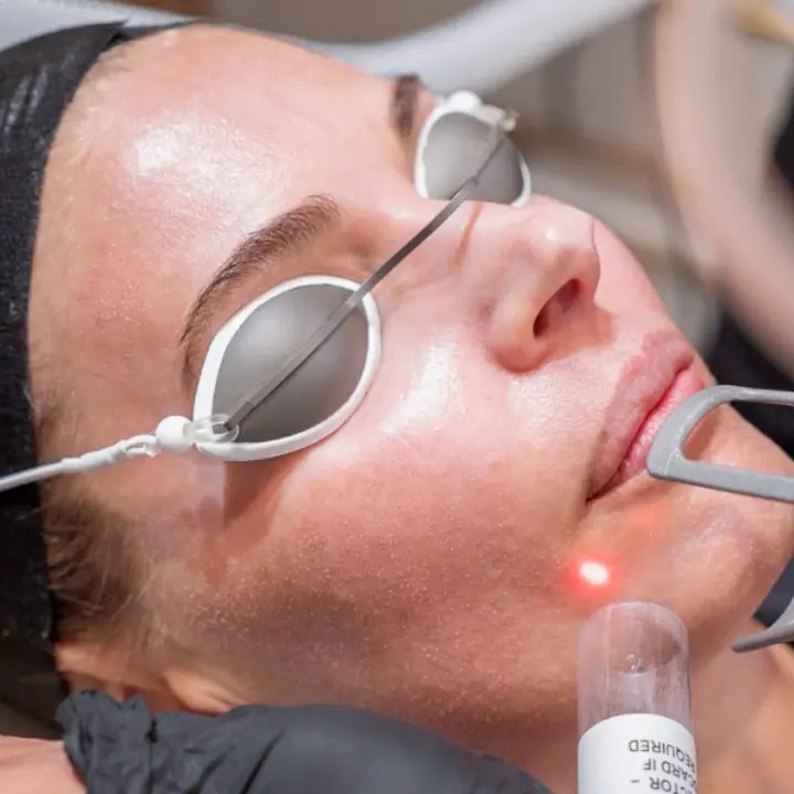 Solaria CO₂ Laser Resurfacing at azalea health and wellness in altamonte-springs-fl